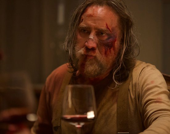 Nicholas Cage with a heavily bruised and bandaged face in a still from 'Pig' (2021)